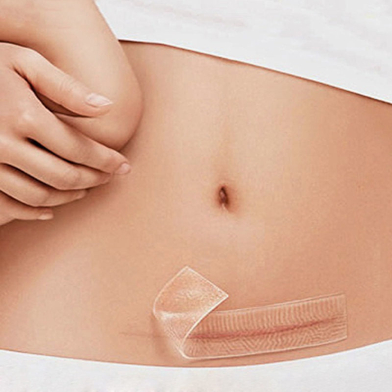 Cinta de Silicona Eliminación Cicatrices South Moon LB0889 Parches sin Dolor