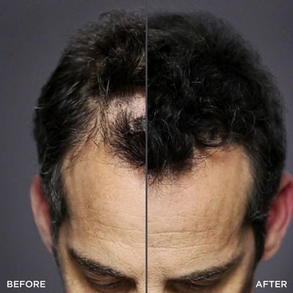 Kit de Polvo Fibras capilares Toppik Hair Cabello grueso y abundante Atomizador